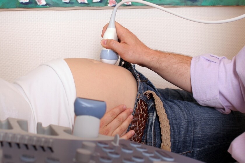 Ultraschalluntersuchung bei Beckenendlage Ultraschall bei Steißlage des Babys