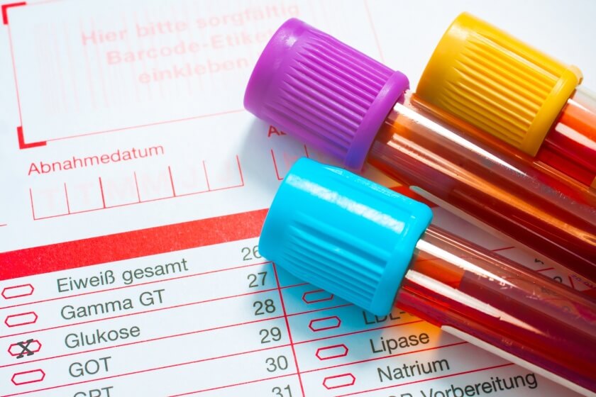 oGTT Blutuntersuchung Blutprobe für Glukosetoleranztest
