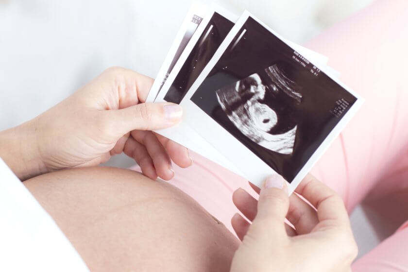 Schwangere hält Ultraschallbilder, die sie zur Erinnerung aufbewahren möchte, in den Händen
