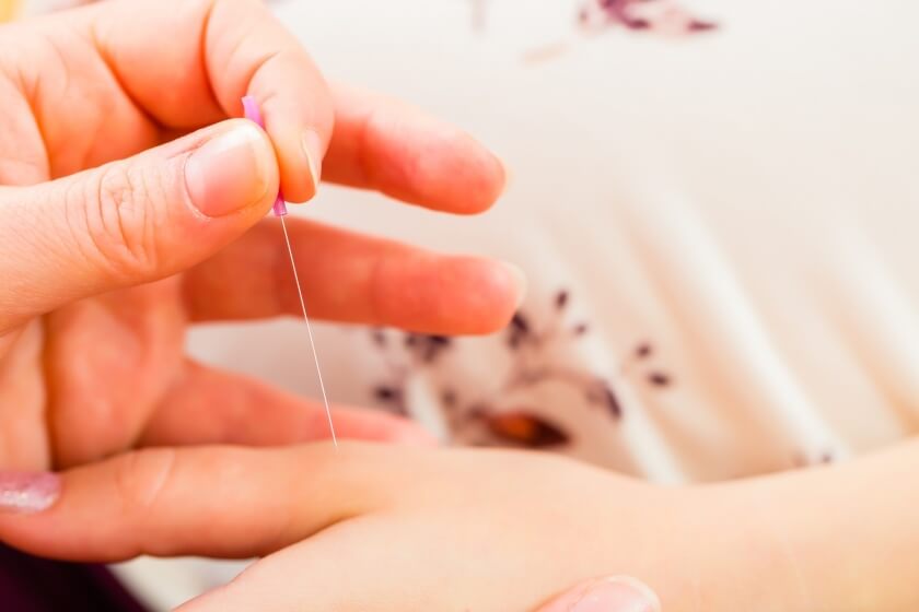 Akupunktur bei einer Schwangeren