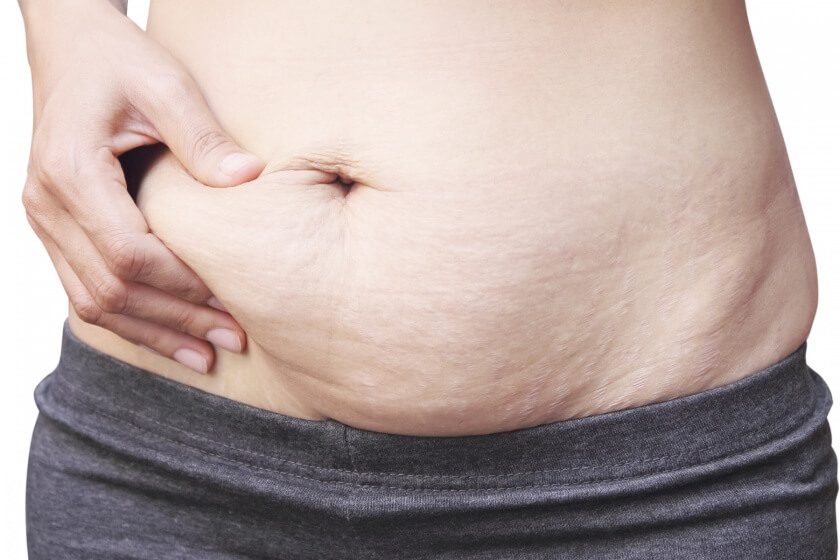 Schwangere hat Übergewicht