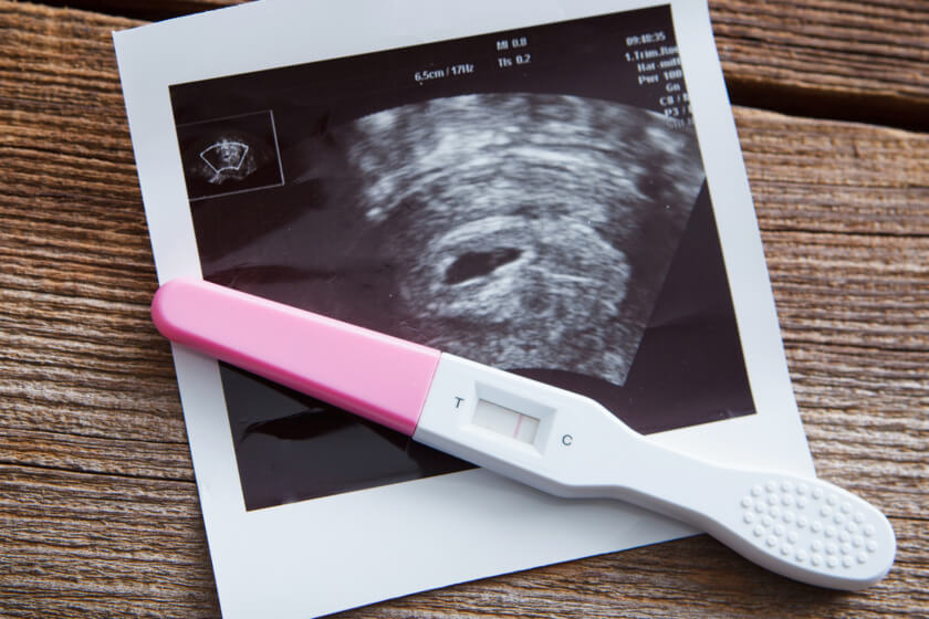Schwangerschaftstest zeigt bei bestehender Schwangerschaft ein negatives Testergebnis